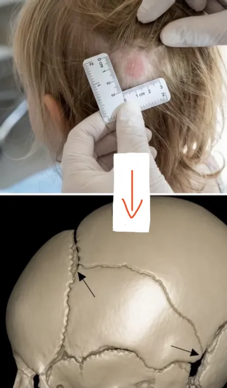 Otites, Maux de tête, Migraines, colères , Châteaubourg, Julie Allemand